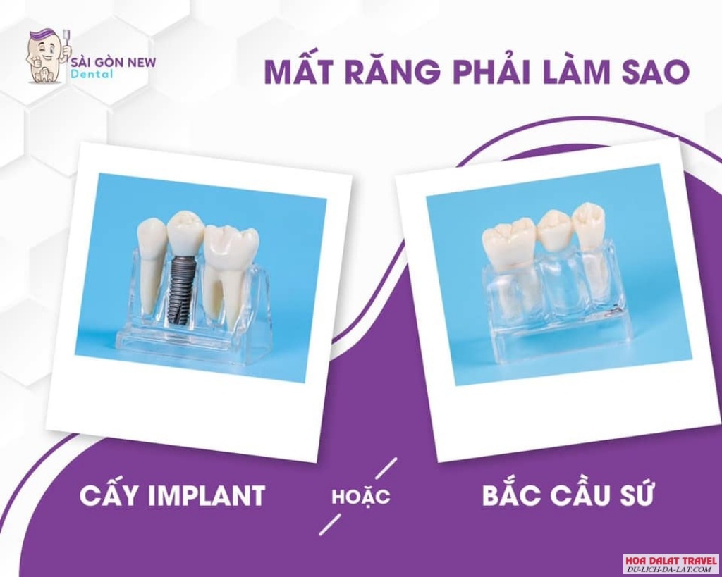 Nha Khoa Sài Gòn