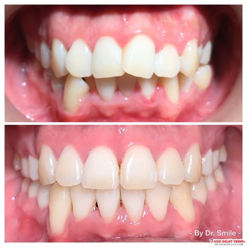 Nha khoa Dr. Smile Đà Lạt