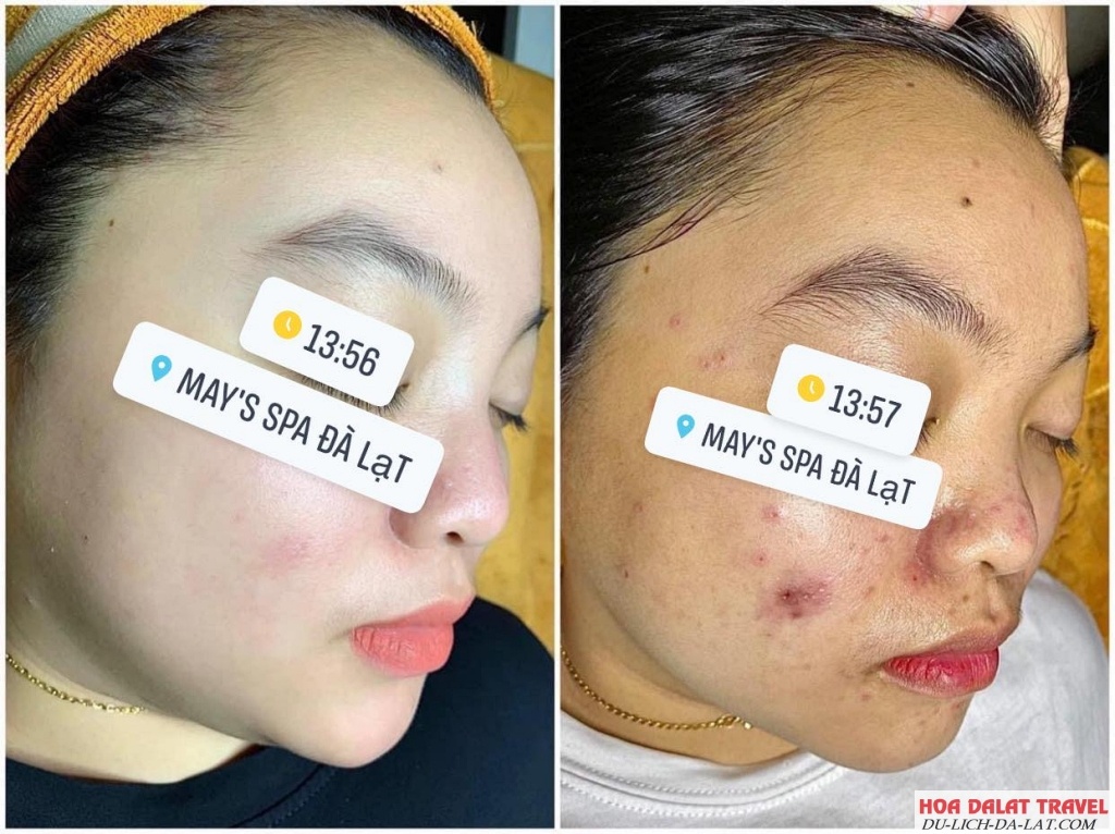 May's Spa Đà Lạt