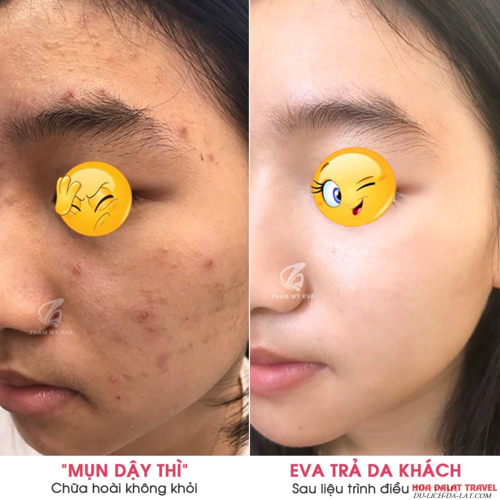 Thẩm Mỹ Viện Eva - Đà Lạt